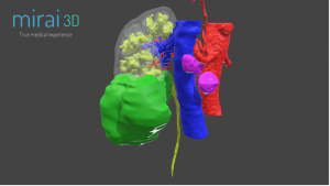 Modelo-3D-digital-rinon